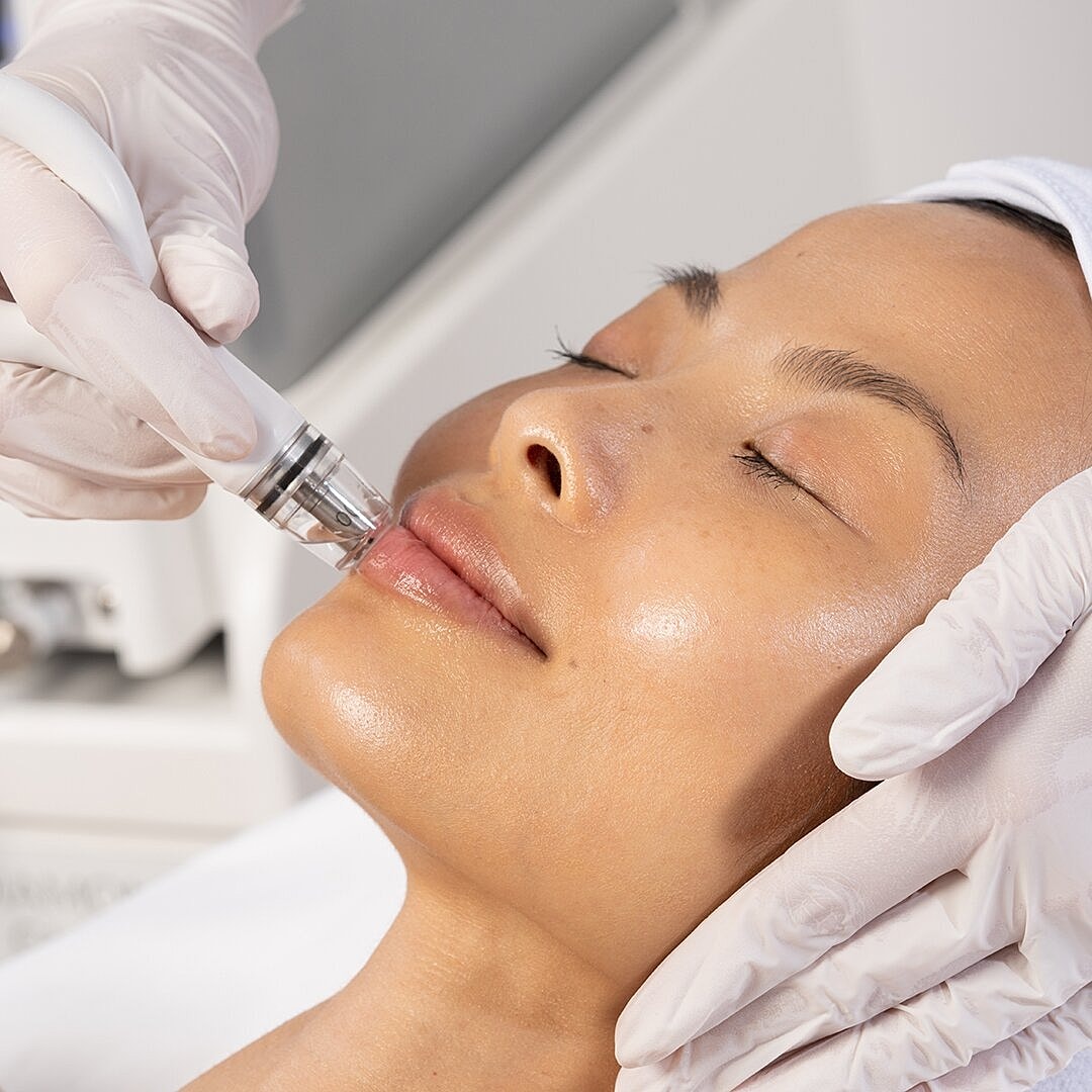 DiamondGlow Vs. HydraFacial