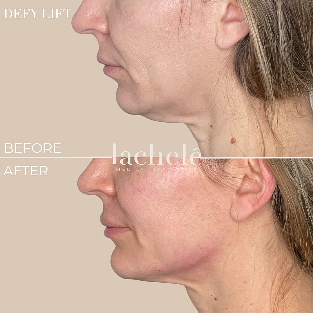 Before and after aesthetic treatment results.