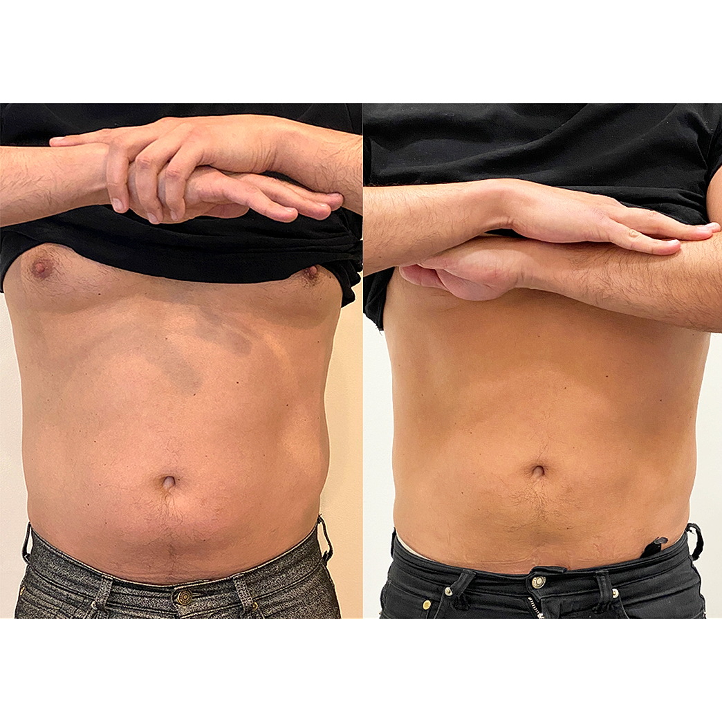 Comparison of two torsos with different poses.