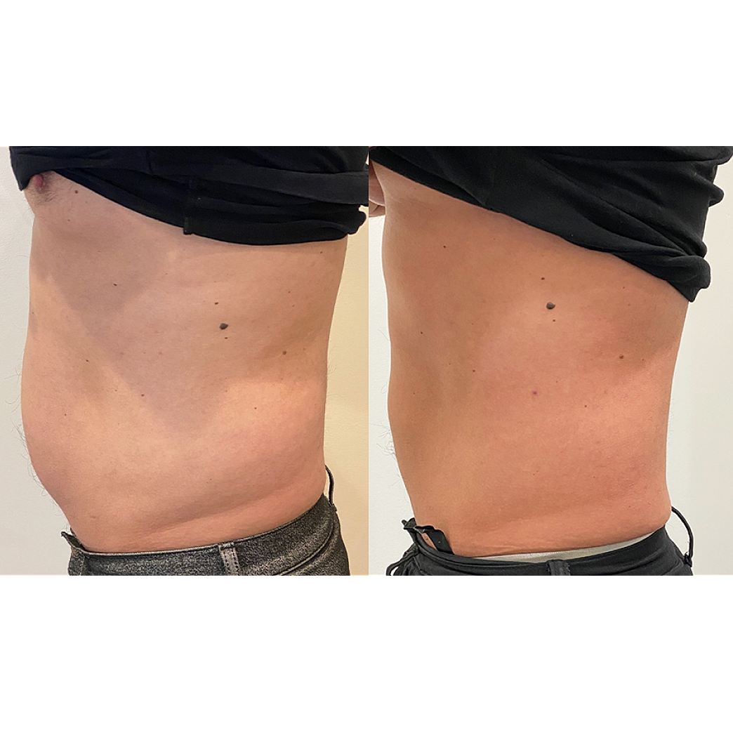 Before and after body transformation photos.