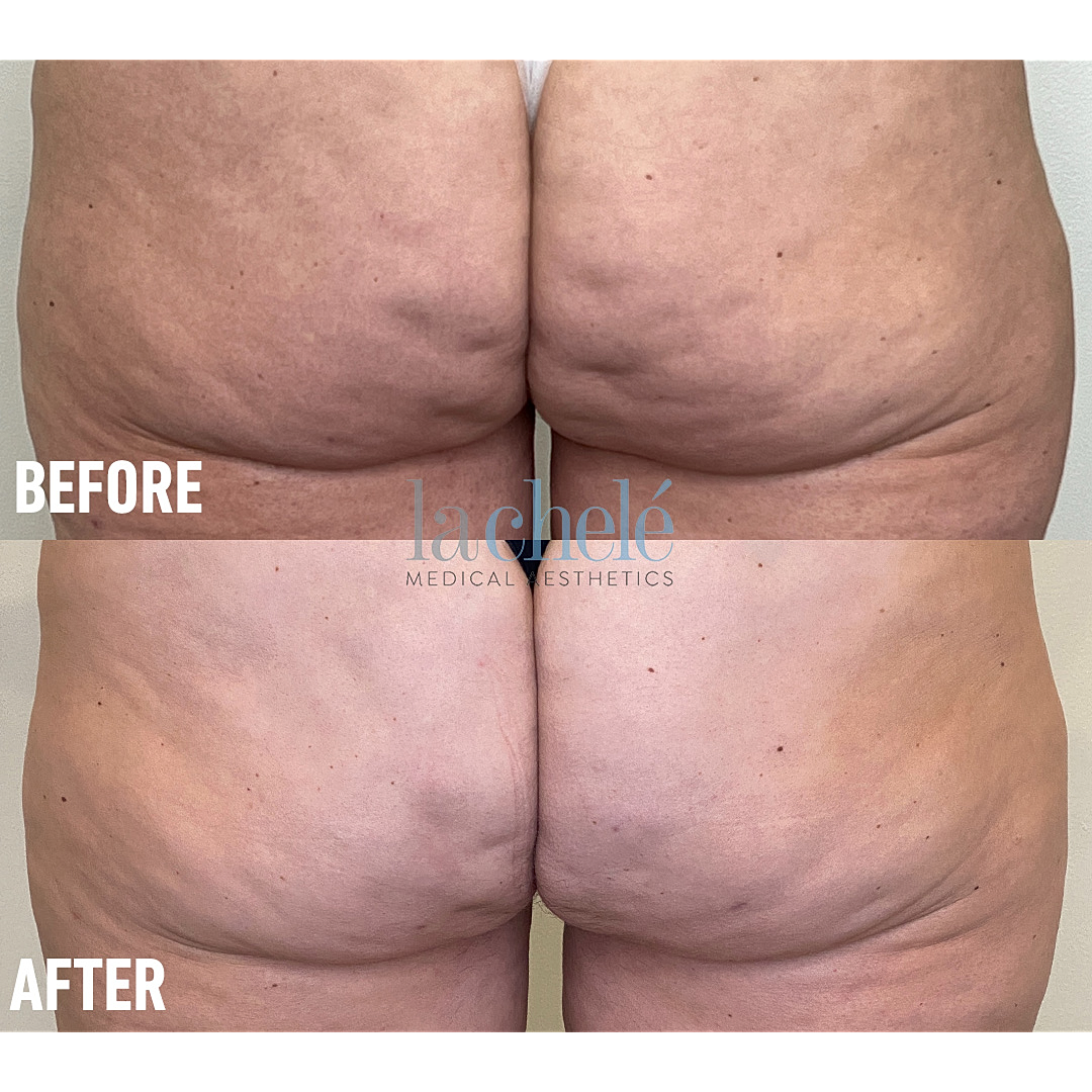 Before and after aesthetic treatment comparison