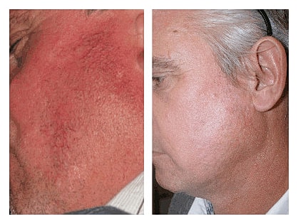 Before and after aesthetic treatment results.