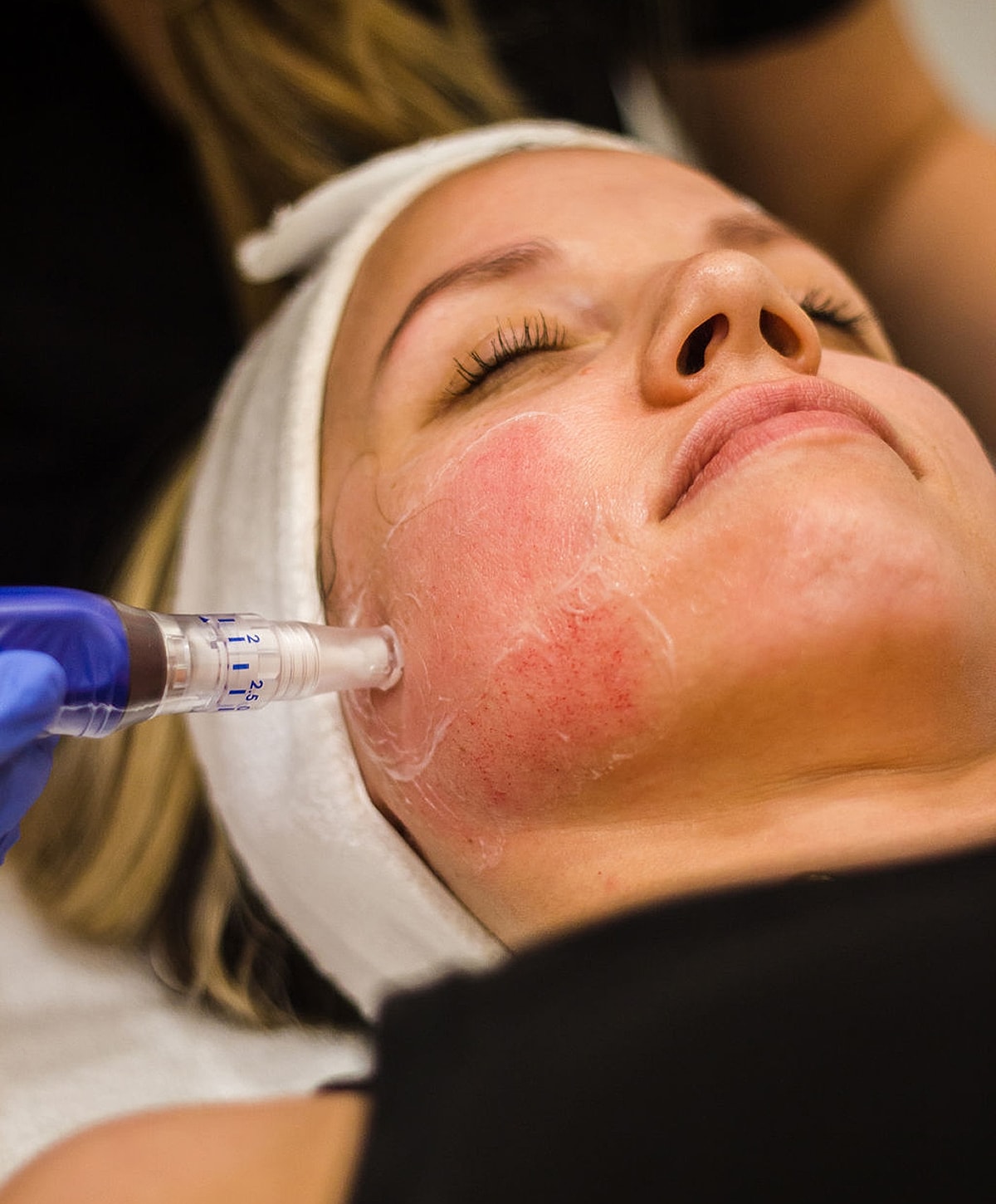 Medical professional preparing patient for procedure.