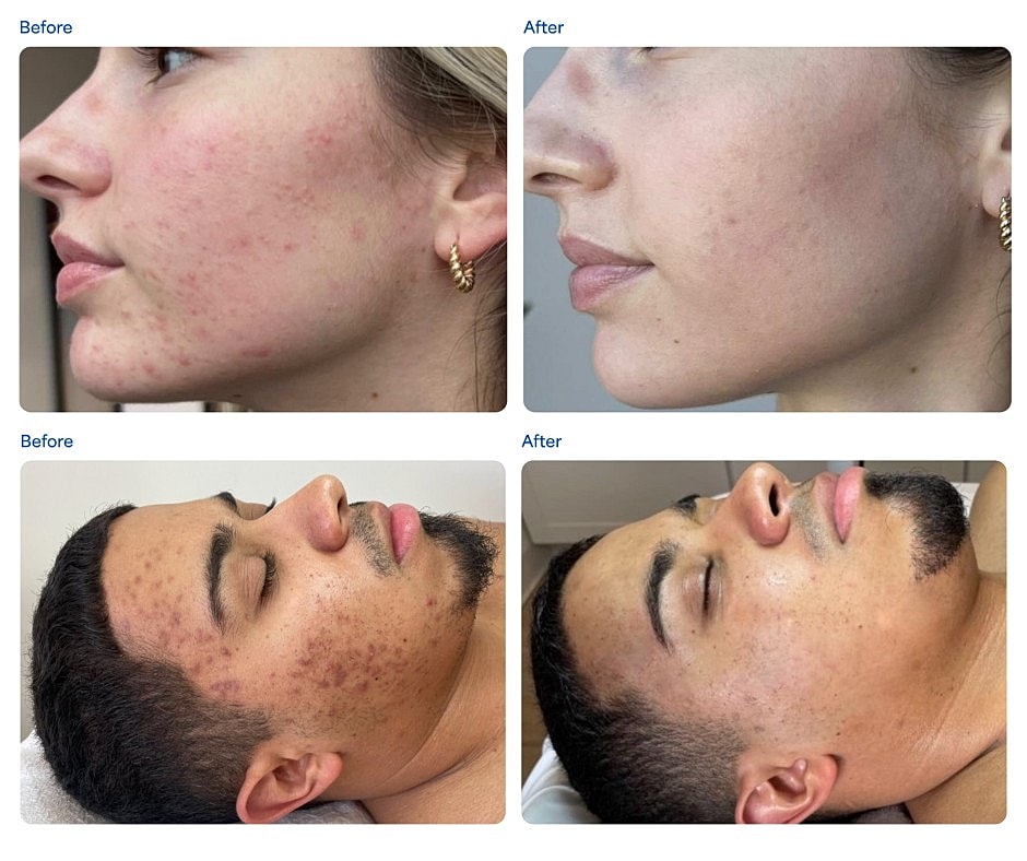Skin treatment results: before and after images.