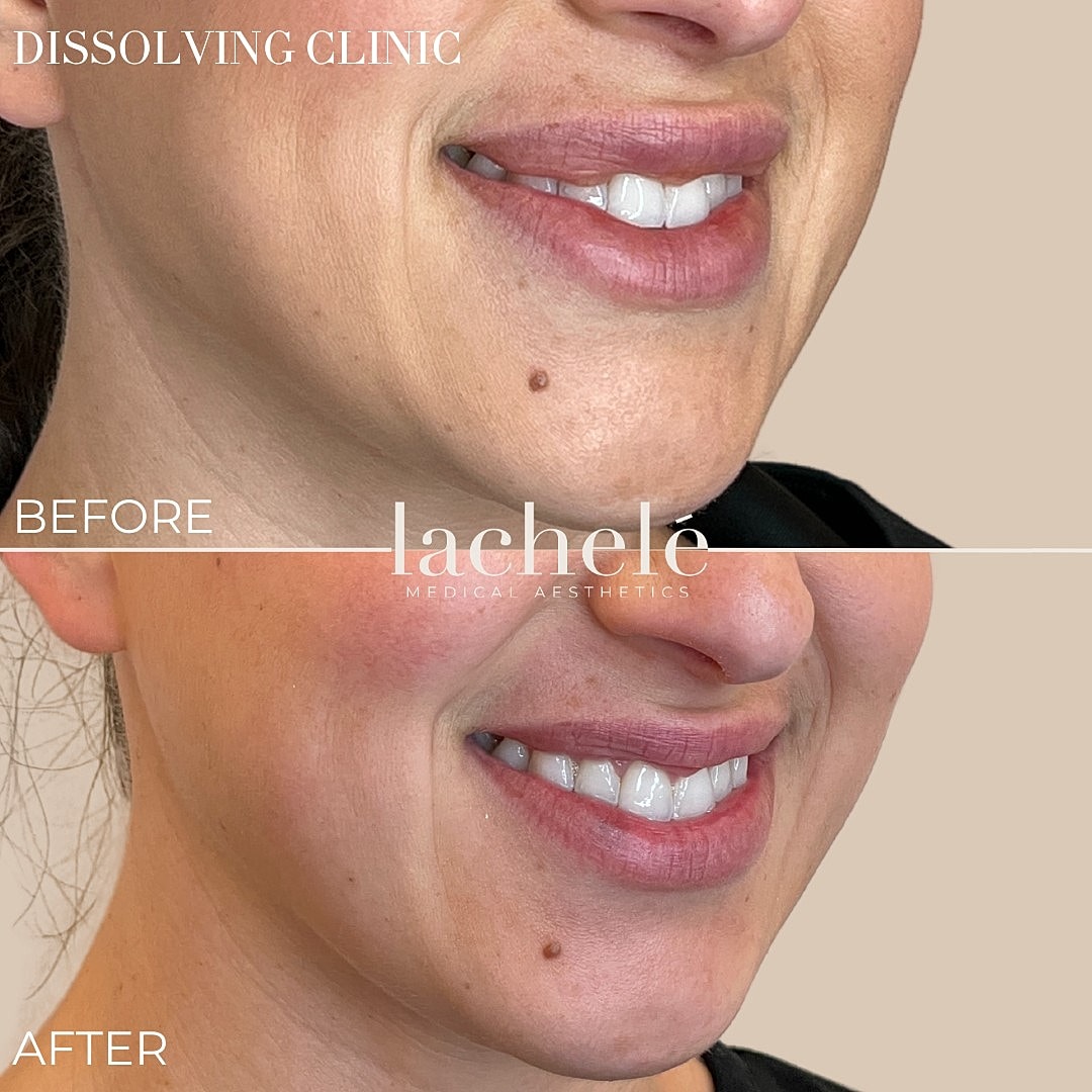 Before and after aesthetic treatment results.