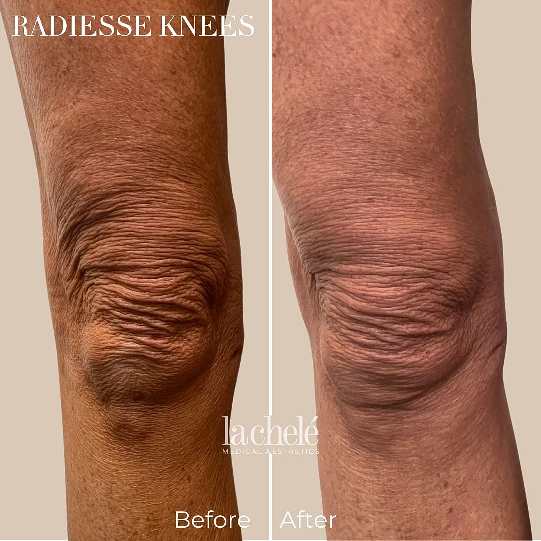 Before and after knee treatment results.