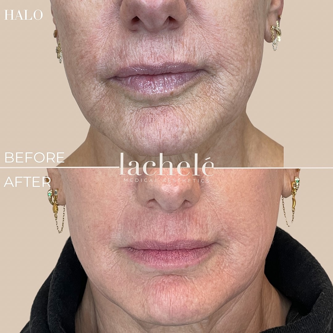 Before and after skin treatment results.
