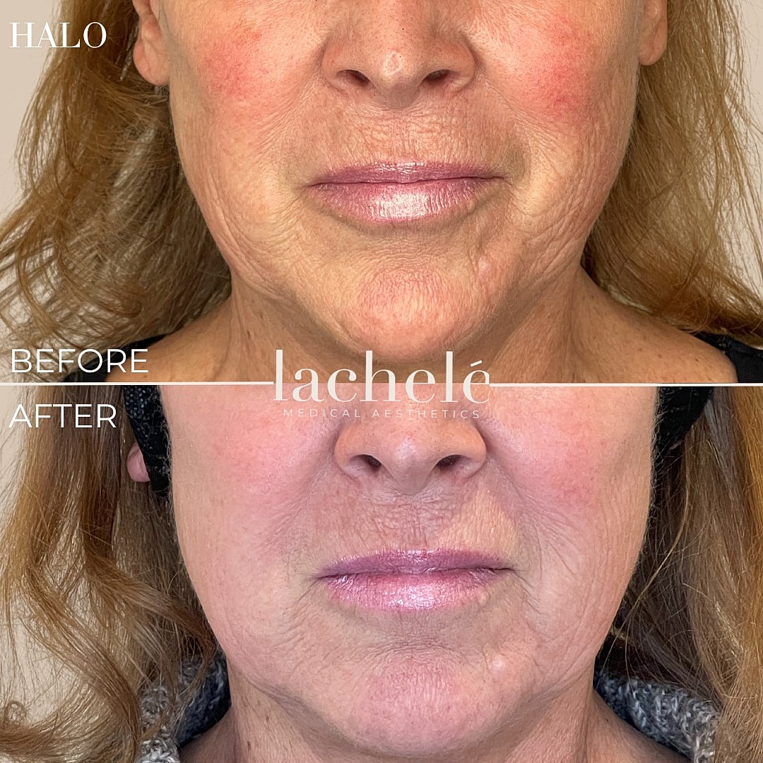 Woman performing yoga in an infrared sauna.