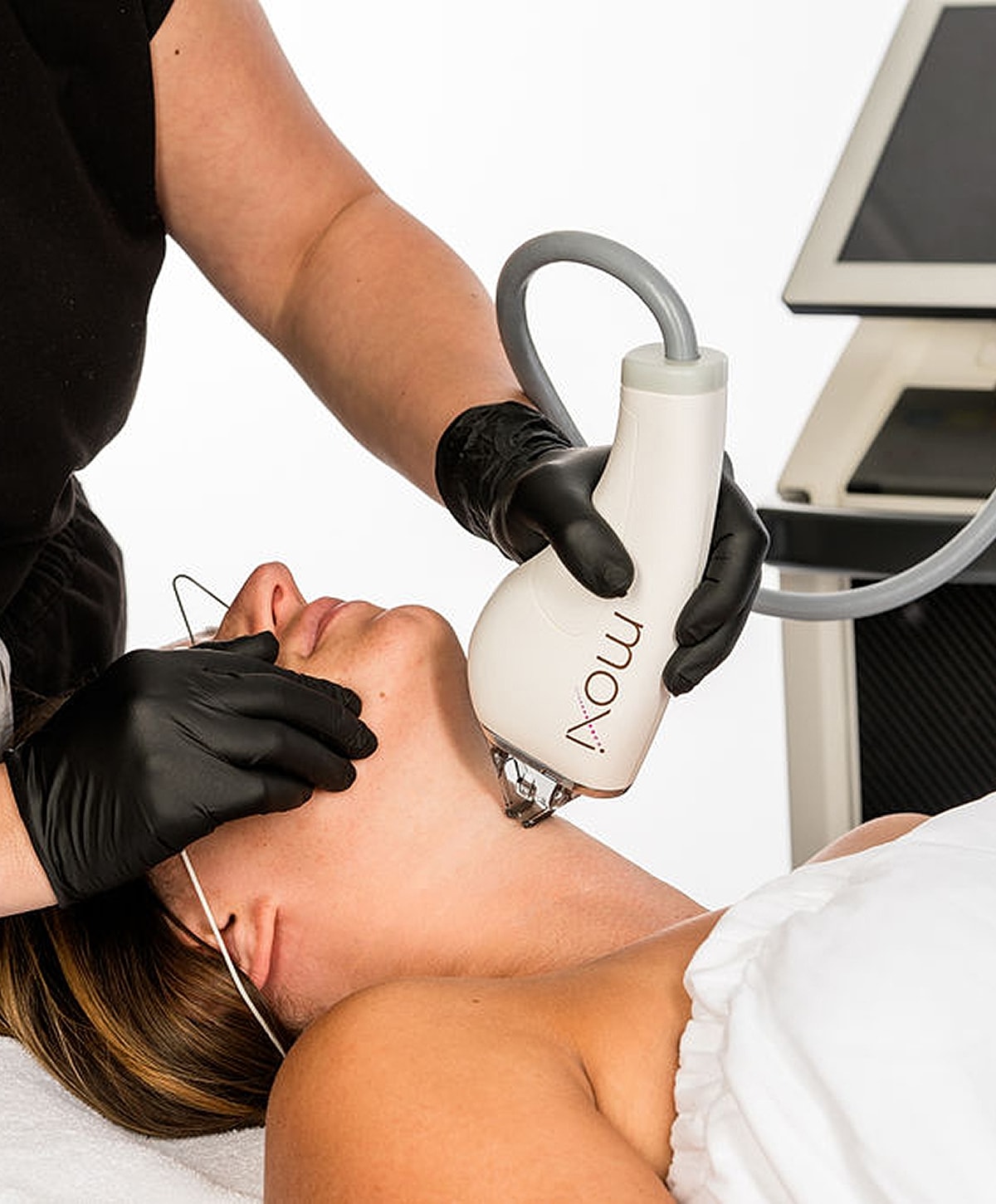 Facial treatment using a laser device.