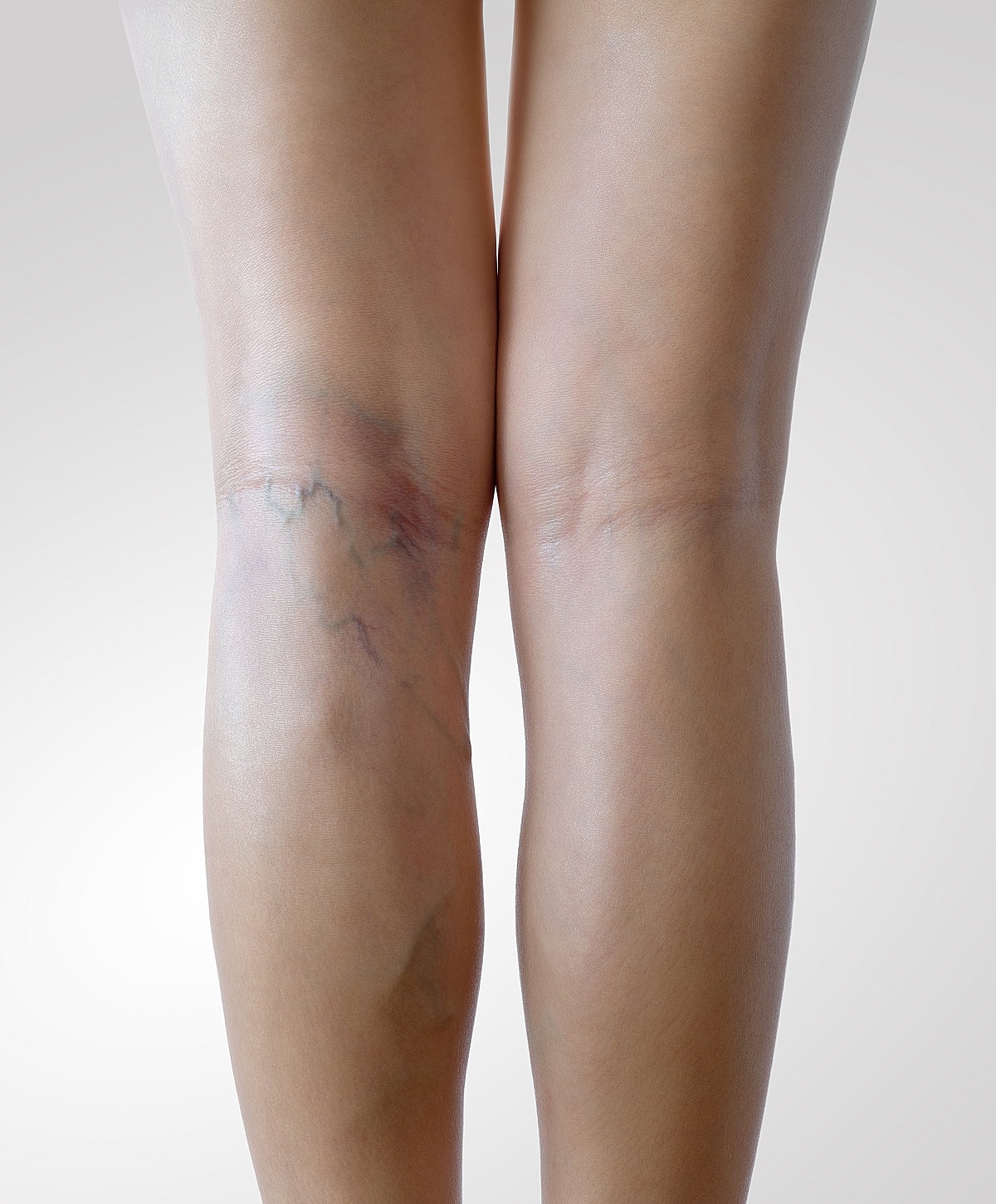 Human foot resting on a light-colored surface.