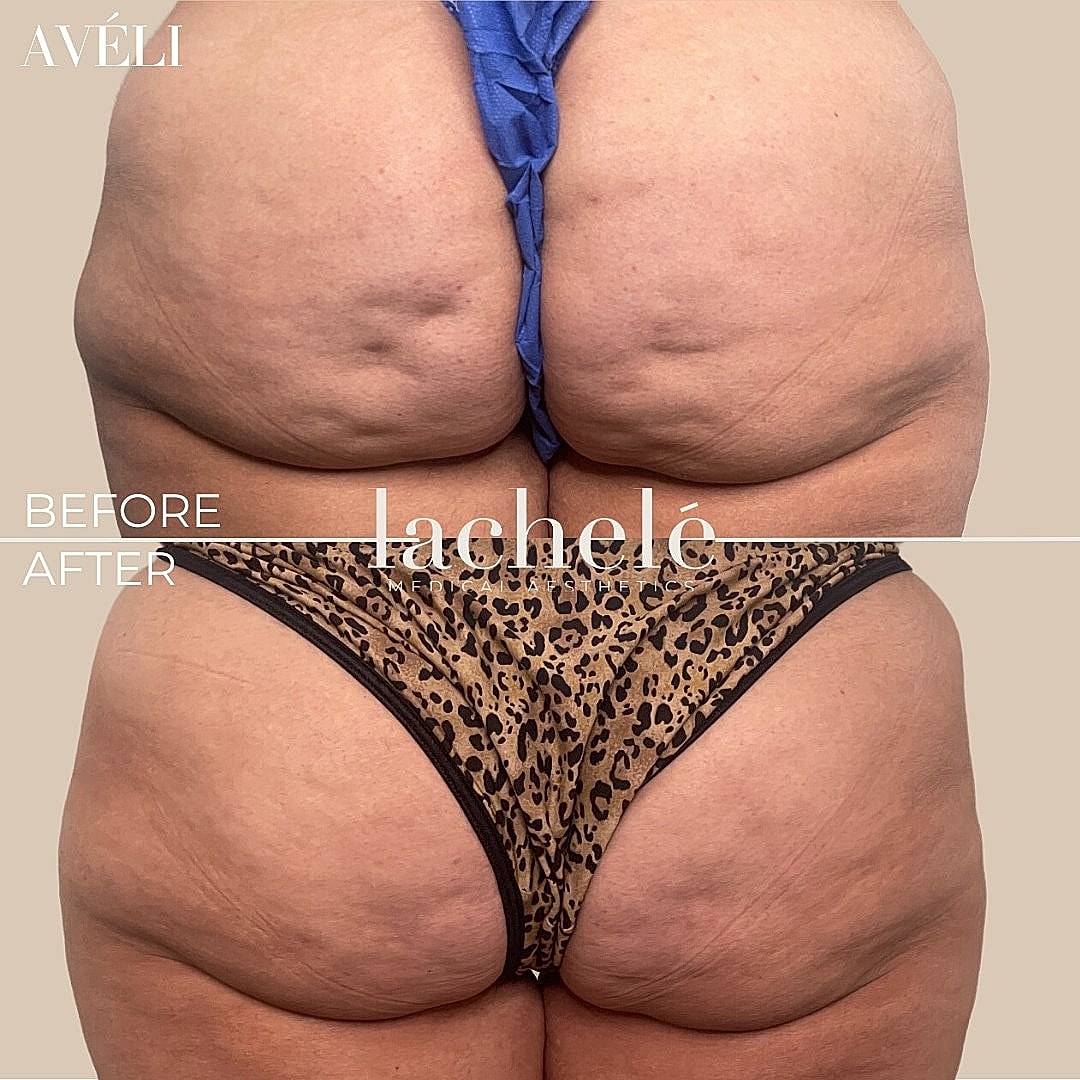 Before and after body transformation comparison