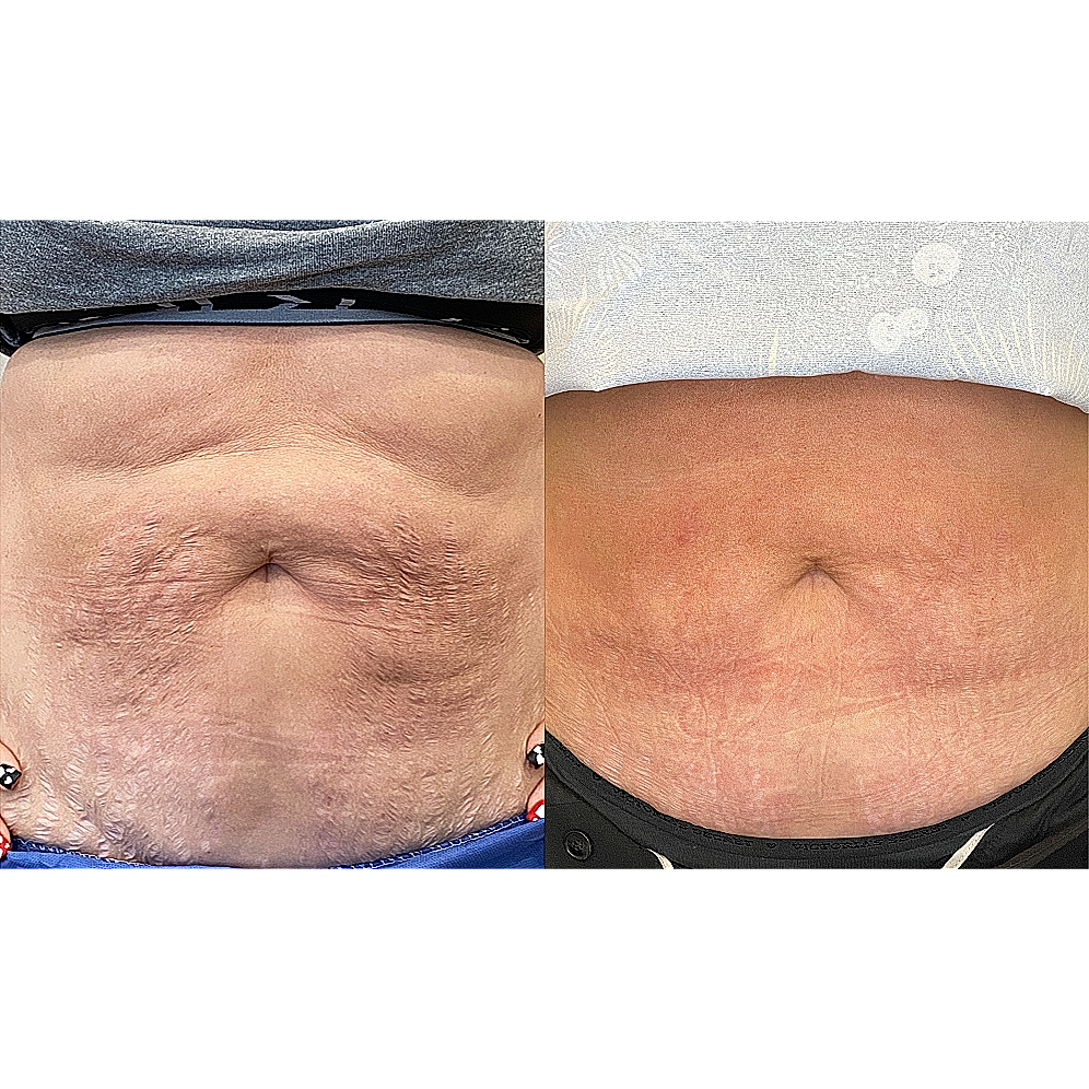 Comparison of two different skin textures.