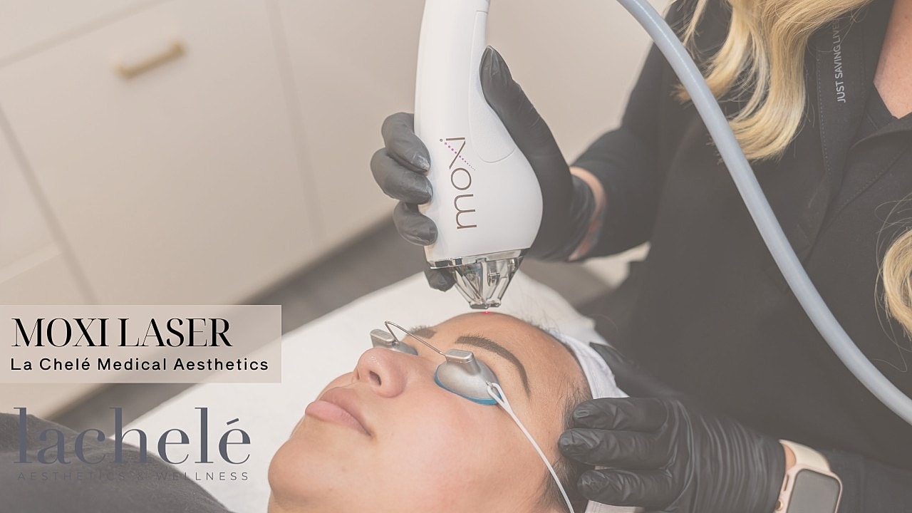 Moxi laser treatment in a clinical setting.