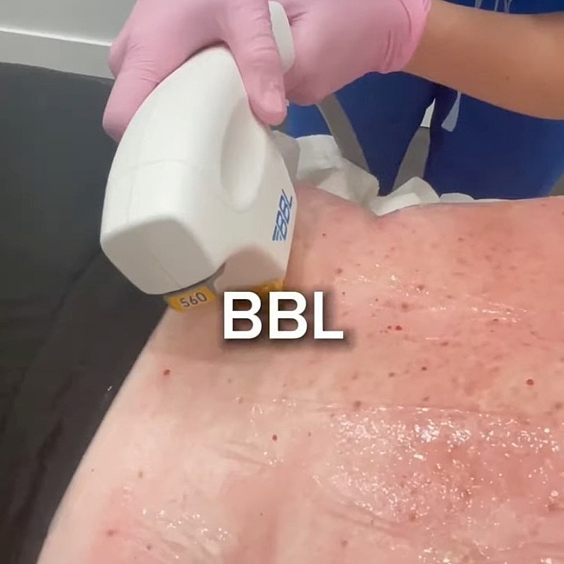 Medical professional beside skincare equipment.