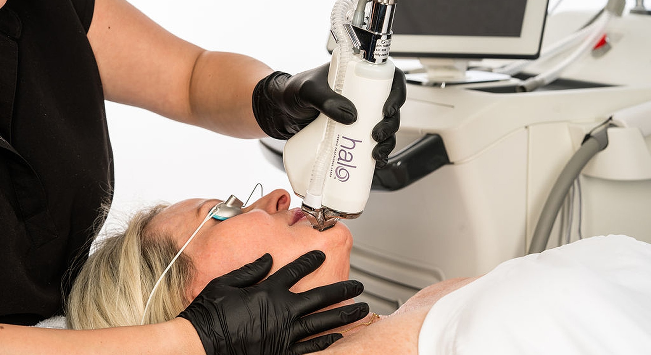 Skin treatment using Halo laser technology session.