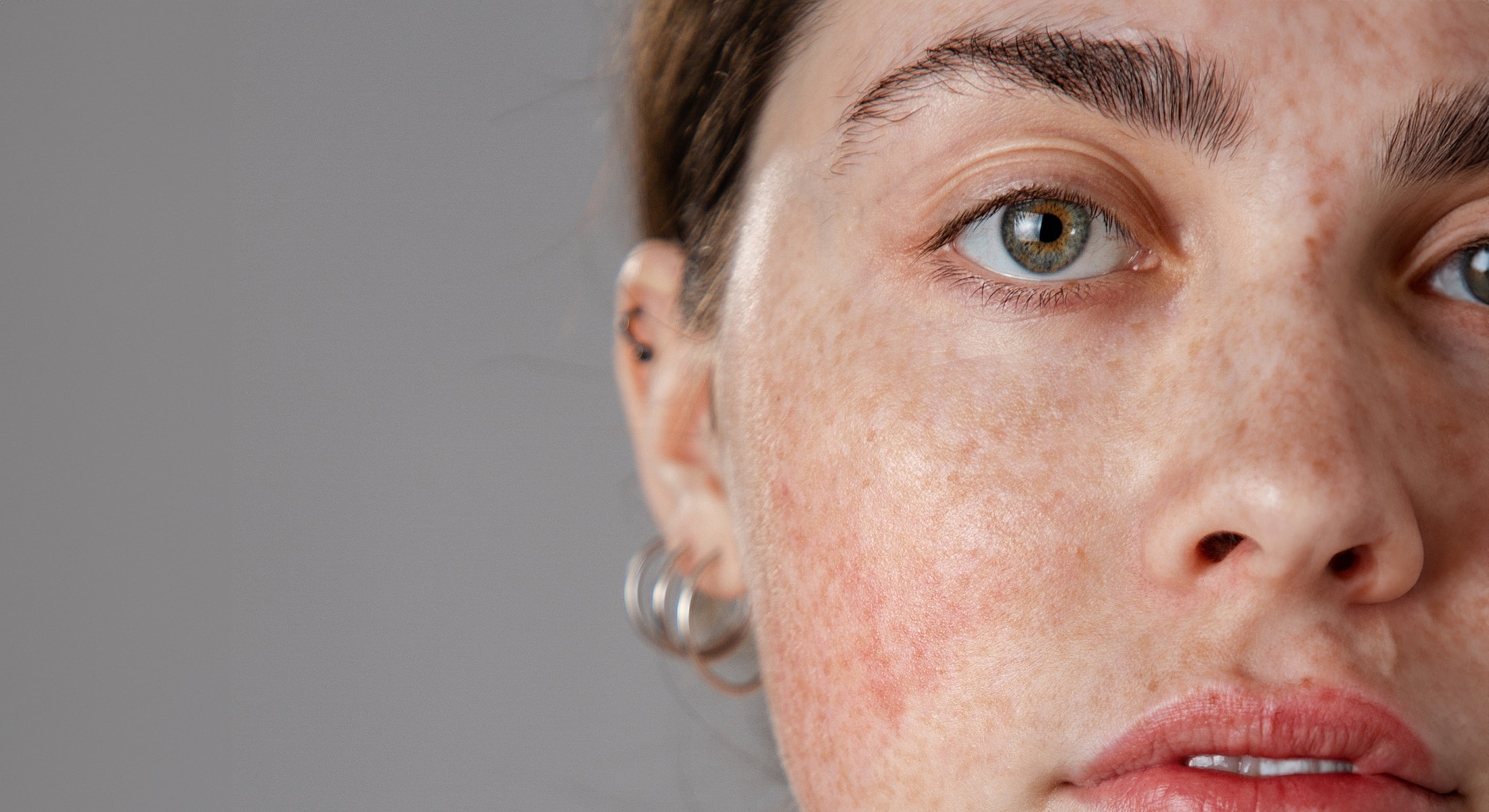 Close-up of a person's face with freckles.